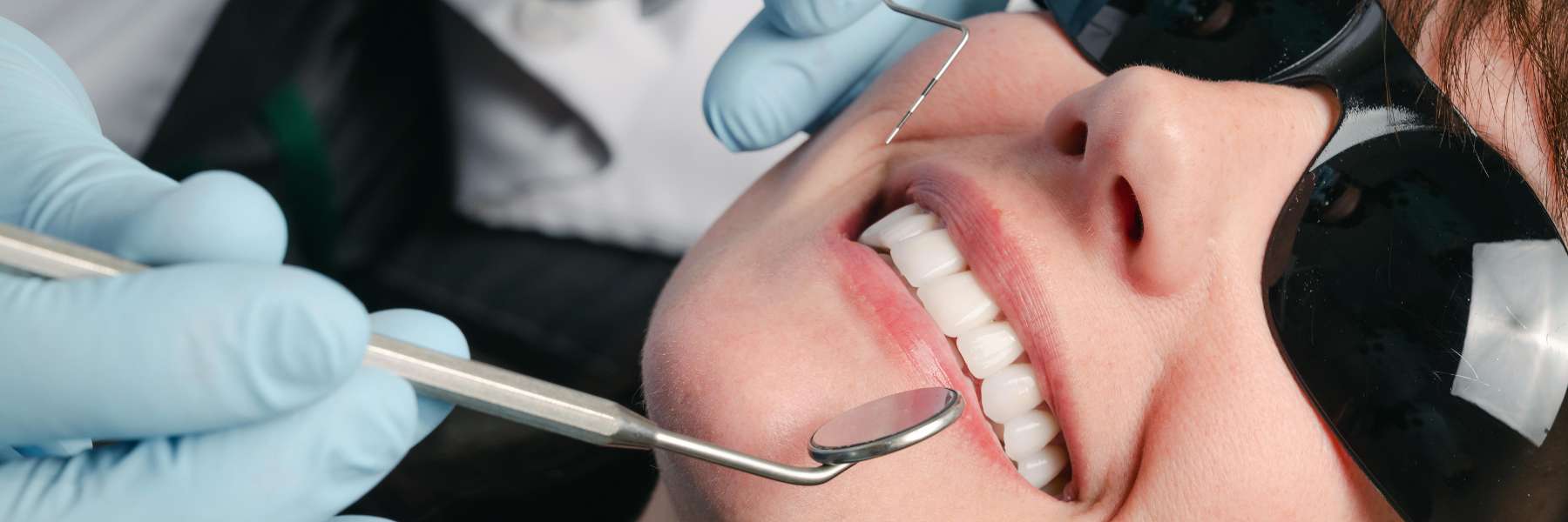Smile Makeovers | Dentist